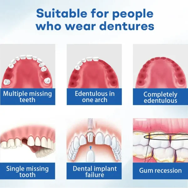 Nurbini® ThermoSeal Fresh Denture - ✅ Clinically proven to completely solve denture slippage and discomfort!
