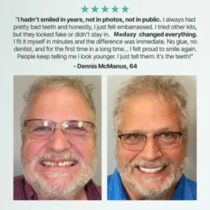 【OFFICIAL STORE】Medazy™ Custom-Fit Full Functional Dentures