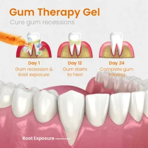 QIAWI™ Gum Repair Treatment Ampoules
