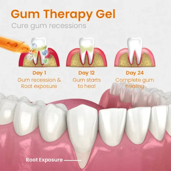 QIAWI™ Gum Repair Treatment Ampoules