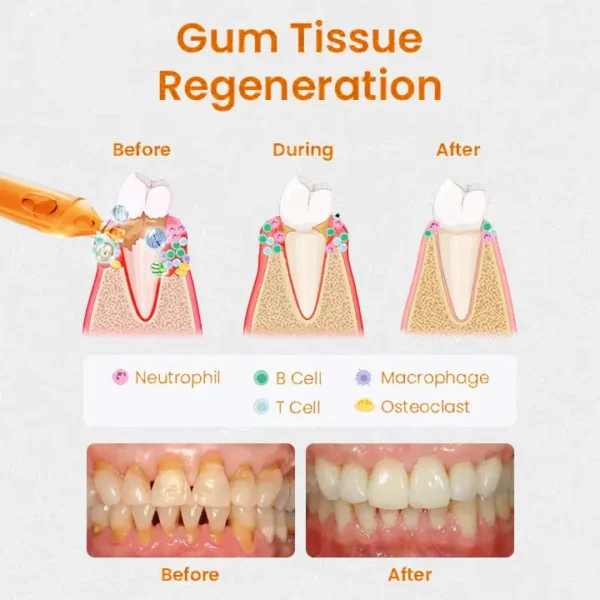 QIAWI™ Gum Repair Treatment Ampoules