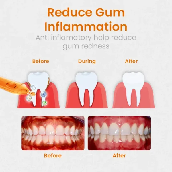 QIAWI™ Gum Repair Treatment Ampoules