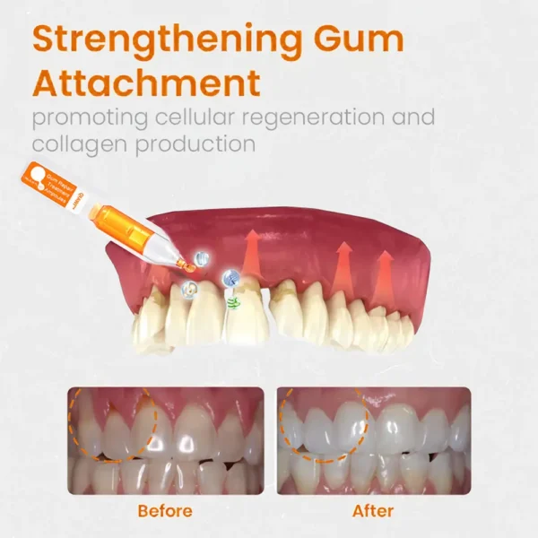 QIAWI™ Gum Repair Treatment Ampoules