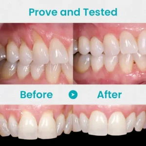 QIAWI™ Gum Repair Treatment Ampoules