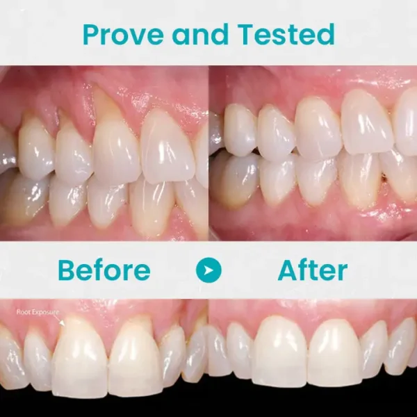 QIAWI™ Gum Repair Treatment Ampoules