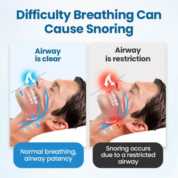 Timilk® SnoreLess Nasal Breather