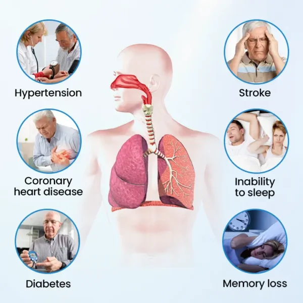 Timilk® SnoreLess Nasal Breather