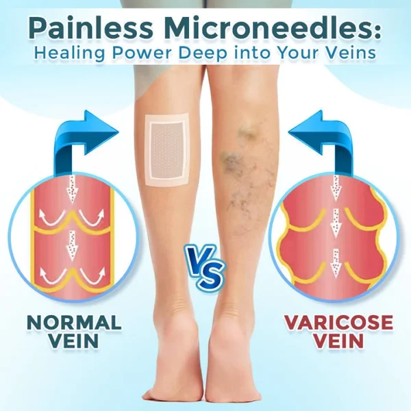 BQYOOM™ VenaRestore MicroNeedle Vein Repair Patch