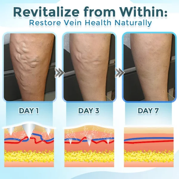BQYOOM™ VenaRestore MicroNeedle Vein Repair Patch