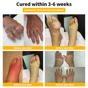 Zentheca BeeThera | Bee Venom-Infused Relief for Bones & Joints