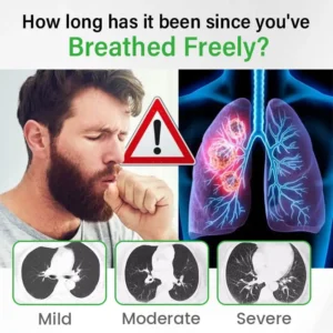 HISTONE® Lung health Detox Inhaler