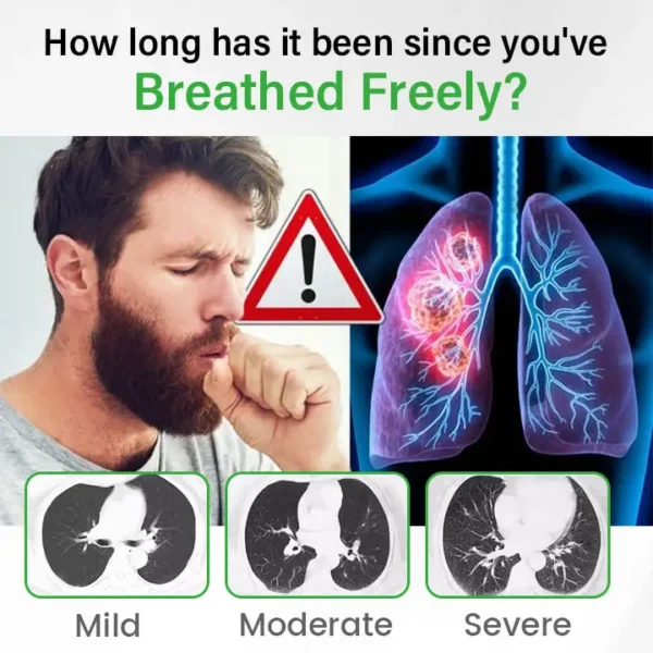 HISTONE® Lung health Detox Inhaler