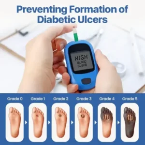 Blizkox® VitaGluco Diabetes Treatment Cream