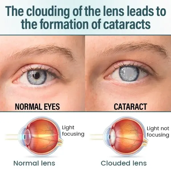 Divifit™ Nano Eye Drops Serum