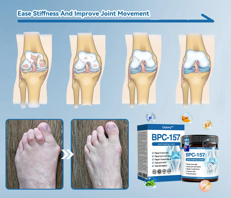 Outeny™ BPC-157 Joint Healing Cream