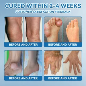 Outeny™ BPC-157 Joint Healing Cream