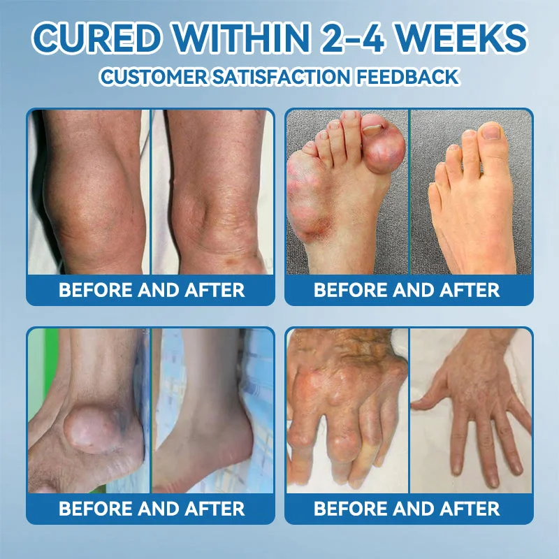 Outeny™ BPC-157 Joint Healing Cream