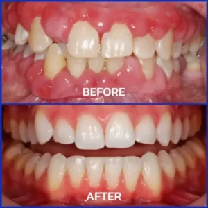 ❤️Rolimey® VioGloss Bienengift-Zahntherapie Oral Power 🦷 (🇩🇪 BZÄK Zugelassen)