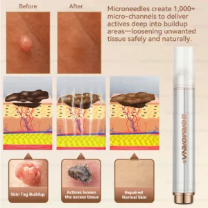 ๐ท๐๐
๐๐๐
๐๐ดยฎ ๐ ๐๐ญ๐๐ฆ ๐๐๐ฅ๐ฅ ๐๐๐๐ ๐๐๐ฉ๐๐ข๐ซ ๐๐ข๐ฅ๐ค ๐ | ๐๐๐๐๐๐๐ ๐๐ฑ๐จ๐ฌ๐จ๐ฆ๐-๐๐ง๐๐ฎ๐ฌ๐๐ ๐๐จ๐ซ ๐๐ค๐ข๐ง ๐๐๐ ๐๐ง๐๐ซ๐๐ญ๐ข๐จ๐ง & ๐๐ฆ๐ฉ๐๐ซ๐๐๐๐ญ๐ข๐จ๐ง ๐๐จ๐ซ๐ซ๐๐๐ญ๐ข๐จ๐ง