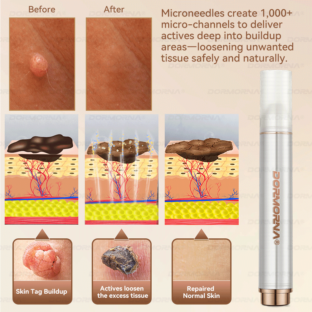 ๐ท๐๐
๐๐๐
๐๐ดยฎ ๐ ๐๐ญ๐๐ฆ ๐๐๐ฅ๐ฅ ๐๐๐๐ ๐๐๐ฉ๐๐ข๐ซ ๐๐ข๐ฅ๐ค ๐ | ๐๐๐๐๐๐๐ ๐๐ฑ๐จ๐ฌ๐จ๐ฆ๐-๐๐ง๐๐ฎ๐ฌ๐๐ ๐๐จ๐ซ ๐๐ค๐ข๐ง ๐๐๐ ๐๐ง๐๐ซ๐๐ญ๐ข๐จ๐ง & ๐๐ฆ๐ฉ๐๐ซ๐๐๐๐ญ๐ข๐จ๐ง ๐๐จ๐ซ๐ซ๐๐๐ญ๐ข๐จ๐ง