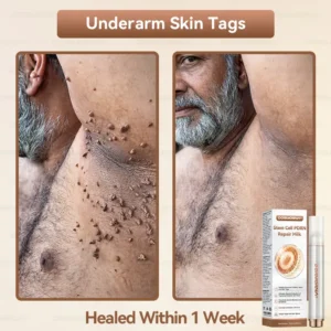 ๐ท๐๐
๐๐๐
๐๐ดยฎ ๐ ๐๐ญ๐๐ฆ ๐๐๐ฅ๐ฅ ๐๐๐๐ ๐๐๐ฉ๐๐ข๐ซ ๐๐ข๐ฅ๐ค ๐ | ๐๐๐๐๐๐๐ ๐๐ฑ๐จ๐ฌ๐จ๐ฆ๐-๐๐ง๐๐ฎ๐ฌ๐๐ ๐๐จ๐ซ ๐๐ค๐ข๐ง ๐๐๐ ๐๐ง๐๐ซ๐๐ญ๐ข๐จ๐ง & ๐๐ฆ๐ฉ๐๐ซ๐๐๐๐ญ๐ข๐จ๐ง ๐๐จ๐ซ๐ซ๐๐๐ญ๐ข๐จ๐ง