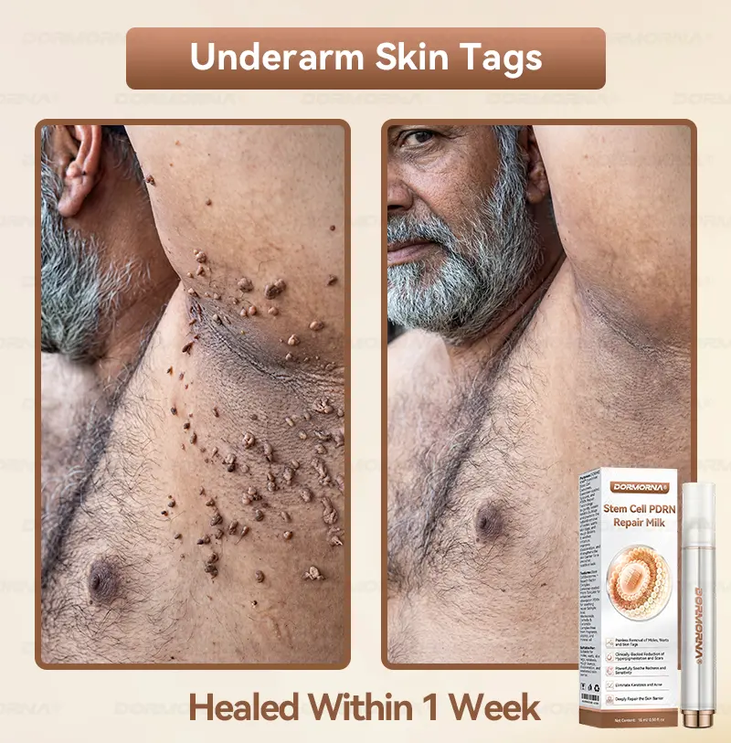 ๐ท๐๐
๐๐๐
๐๐ดยฎ ๐ ๐๐ญ๐๐ฆ ๐๐๐ฅ๐ฅ ๐๐๐๐ ๐๐๐ฉ๐๐ข๐ซ ๐๐ข๐ฅ๐ค ๐ | ๐๐๐๐๐๐๐ ๐๐ฑ๐จ๐ฌ๐จ๐ฆ๐-๐๐ง๐๐ฎ๐ฌ๐๐ ๐๐จ๐ซ ๐๐ค๐ข๐ง ๐๐๐ ๐๐ง๐๐ซ๐๐ญ๐ข๐จ๐ง & ๐๐ฆ๐ฉ๐๐ซ๐๐๐๐ญ๐ข๐จ๐ง ๐๐จ๐ซ๐ซ๐๐๐ญ๐ข๐จ๐ง