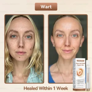 𝐷𝑂𝑅𝑀𝑂𝑅𝑁𝐴® 🍀 𝐒𝐭𝐞𝐦 𝐂𝐞𝐥𝐥 𝐏𝐃𝐑𝐍 𝐑𝐞𝐩𝐚𝐢𝐫 𝐌𝐢𝐥𝐤 🍁 | 𝟐𝟎𝟎𝟎𝐏𝐏𝐌 𝐄𝐱𝐨𝐬𝐨𝐦𝐞-𝐈𝐧𝐟𝐮𝐬𝐞𝐝 𝐟𝐨𝐫 𝐒𝐤𝐢𝐧 𝐑𝐞𝐠𝐞𝐧𝐞𝐫𝐚𝐭𝐢𝐨𝐧 & 𝐈𝐦𝐩𝐞𝐫𝐟𝐞𝐜𝐭𝐢𝐨𝐧 𝐂𝐨𝐫𝐫𝐞𝐜𝐭𝐢𝐨𝐧