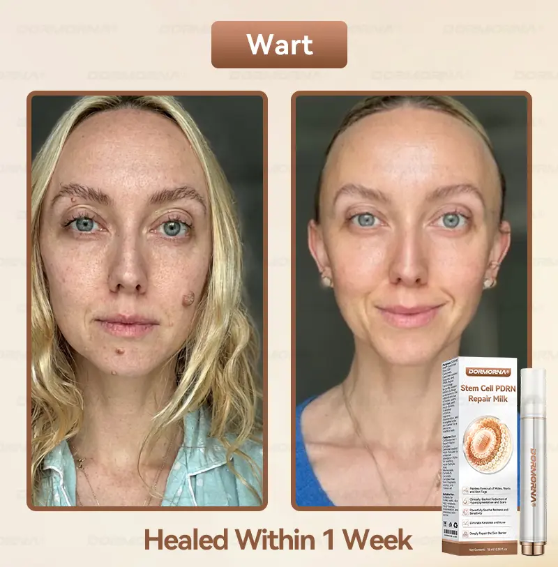 ๐ท๐๐
๐๐๐
๐๐ดยฎ ๐ ๐๐ญ๐๐ฆ ๐๐๐ฅ๐ฅ ๐๐๐๐ ๐๐๐ฉ๐๐ข๐ซ ๐๐ข๐ฅ๐ค ๐ | ๐๐๐๐๐๐๐ ๐๐ฑ๐จ๐ฌ๐จ๐ฆ๐-๐๐ง๐๐ฎ๐ฌ๐๐ ๐๐จ๐ซ ๐๐ค๐ข๐ง ๐๐๐ ๐๐ง๐๐ซ๐๐ญ๐ข๐จ๐ง & ๐๐ฆ๐ฉ๐๐ซ๐๐๐๐ญ๐ข๐จ๐ง ๐๐จ๐ซ๐ซ๐๐๐ญ๐ข๐จ๐ง