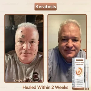 ๐ท๐๐
๐๐๐
๐๐ดยฎ ๐ ๐๐ญ๐๐ฆ ๐๐๐ฅ๐ฅ ๐๐๐๐ ๐๐๐ฉ๐๐ข๐ซ ๐๐ข๐ฅ๐ค ๐ | ๐๐๐๐๐๐๐ ๐๐ฑ๐จ๐ฌ๐จ๐ฆ๐-๐๐ง๐๐ฎ๐ฌ๐๐ ๐๐จ๐ซ ๐๐ค๐ข๐ง ๐๐๐ ๐๐ง๐๐ซ๐๐ญ๐ข๐จ๐ง & ๐๐ฆ๐ฉ๐๐ซ๐๐๐๐ญ๐ข๐จ๐ง ๐๐จ๐ซ๐ซ๐๐๐ญ๐ข๐จ๐ง