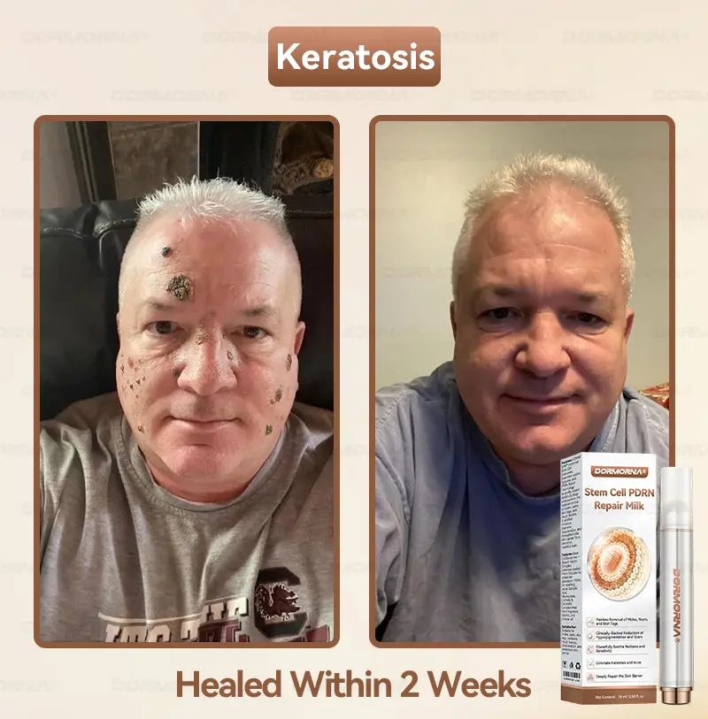 ๐ท๐๐
๐๐๐
๐๐ดยฎ ๐ ๐๐ญ๐๐ฆ ๐๐๐ฅ๐ฅ ๐๐๐๐ ๐๐๐ฉ๐๐ข๐ซ ๐๐ข๐ฅ๐ค ๐ | ๐๐๐๐๐๐๐ ๐๐ฑ๐จ๐ฌ๐จ๐ฆ๐-๐๐ง๐๐ฎ๐ฌ๐๐ ๐๐จ๐ซ ๐๐ค๐ข๐ง ๐๐๐ ๐๐ง๐๐ซ๐๐ญ๐ข๐จ๐ง & ๐๐ฆ๐ฉ๐๐ซ๐๐๐๐ญ๐ข๐จ๐ง ๐๐จ๐ซ๐ซ๐๐๐ญ๐ข๐จ๐ง