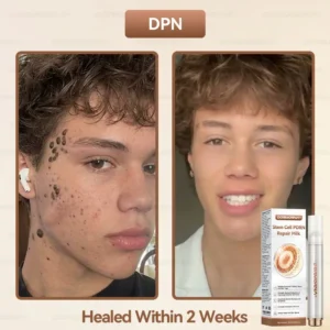 ๐ท๐๐
๐๐๐
๐๐ดยฎ ๐ ๐๐ญ๐๐ฆ ๐๐๐ฅ๐ฅ ๐๐๐๐ ๐๐๐ฉ๐๐ข๐ซ ๐๐ข๐ฅ๐ค ๐ | ๐๐๐๐๐๐๐ ๐๐ฑ๐จ๐ฌ๐จ๐ฆ๐-๐๐ง๐๐ฎ๐ฌ๐๐ ๐๐จ๐ซ ๐๐ค๐ข๐ง ๐๐๐ ๐๐ง๐๐ซ๐๐ญ๐ข๐จ๐ง & ๐๐ฆ๐ฉ๐๐ซ๐๐๐๐ญ๐ข๐จ๐ง ๐๐จ๐ซ๐ซ๐๐๐ญ๐ข๐จ๐ง