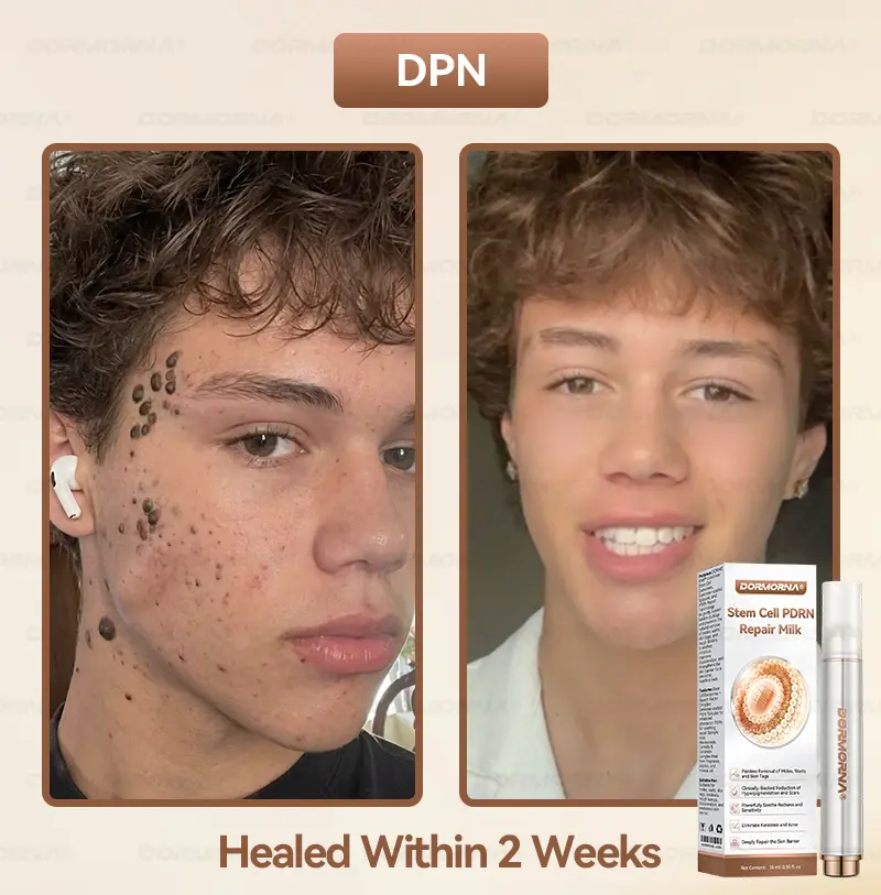 ๐ท๐๐
๐๐๐
๐๐ดยฎ ๐ ๐๐ญ๐๐ฆ ๐๐๐ฅ๐ฅ ๐๐๐๐ ๐๐๐ฉ๐๐ข๐ซ ๐๐ข๐ฅ๐ค ๐ | ๐๐๐๐๐๐๐ ๐๐ฑ๐จ๐ฌ๐จ๐ฆ๐-๐๐ง๐๐ฎ๐ฌ๐๐ ๐๐จ๐ซ ๐๐ค๐ข๐ง ๐๐๐ ๐๐ง๐๐ซ๐๐ญ๐ข๐จ๐ง & ๐๐ฆ๐ฉ๐๐ซ๐๐๐๐ญ๐ข๐จ๐ง ๐๐จ๐ซ๐ซ๐๐๐ญ๐ข๐จ๐ง