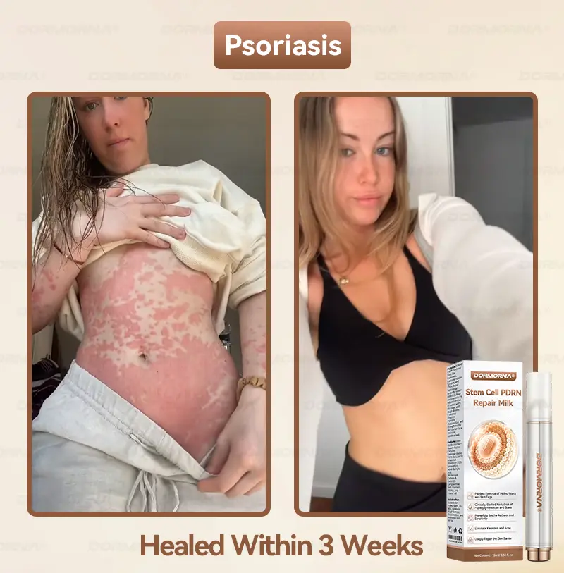 ๐ท๐๐
๐๐๐
๐๐ดยฎ ๐ ๐๐ญ๐๐ฆ ๐๐๐ฅ๐ฅ ๐๐๐๐ ๐๐๐ฉ๐๐ข๐ซ ๐๐ข๐ฅ๐ค ๐ | ๐๐๐๐๐๐๐ ๐๐ฑ๐จ๐ฌ๐จ๐ฆ๐-๐๐ง๐๐ฎ๐ฌ๐๐ ๐๐จ๐ซ ๐๐ค๐ข๐ง ๐๐๐ ๐๐ง๐๐ซ๐๐ญ๐ข๐จ๐ง & ๐๐ฆ๐ฉ๐๐ซ๐๐๐๐ญ๐ข๐จ๐ง ๐๐จ๐ซ๐ซ๐๐๐ญ๐ข๐จ๐ง