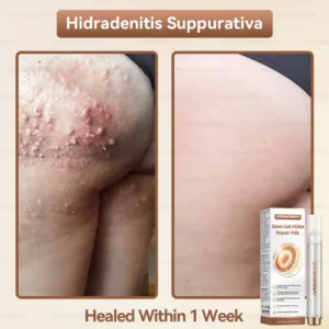 ๐ท๐๐
๐๐๐
๐๐ดยฎ ๐ ๐๐ญ๐๐ฆ ๐๐๐ฅ๐ฅ ๐๐๐๐ ๐๐๐ฉ๐๐ข๐ซ ๐๐ข๐ฅ๐ค ๐ | ๐๐๐๐๐๐๐ ๐๐ฑ๐จ๐ฌ๐จ๐ฆ๐-๐๐ง๐๐ฎ๐ฌ๐๐ ๐๐จ๐ซ ๐๐ค๐ข๐ง ๐๐๐ ๐๐ง๐๐ซ๐๐ญ๐ข๐จ๐ง & ๐๐ฆ๐ฉ๐๐ซ๐๐๐๐ญ๐ข๐จ๐ง ๐๐จ๐ซ๐ซ๐๐๐ญ๐ข๐จ๐ง