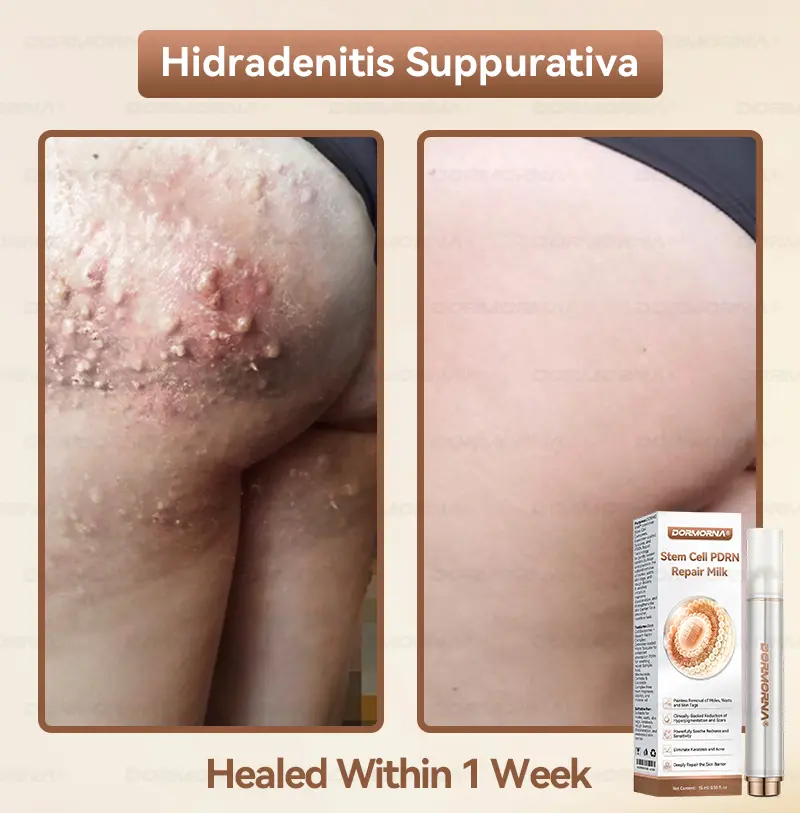 ๐ท๐๐
๐๐๐
๐๐ดยฎ ๐ ๐๐ญ๐๐ฆ ๐๐๐ฅ๐ฅ ๐๐๐๐ ๐๐๐ฉ๐๐ข๐ซ ๐๐ข๐ฅ๐ค ๐ | ๐๐๐๐๐๐๐ ๐๐ฑ๐จ๐ฌ๐จ๐ฆ๐-๐๐ง๐๐ฎ๐ฌ๐๐ ๐๐จ๐ซ ๐๐ค๐ข๐ง ๐๐๐ ๐๐ง๐๐ซ๐๐ญ๐ข๐จ๐ง & ๐๐ฆ๐ฉ๐๐ซ๐๐๐๐ญ๐ข๐จ๐ง ๐๐จ๐ซ๐ซ๐๐๐ญ๐ข๐จ๐ง