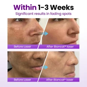 Biancat® SpotErase Probiotic Shield Serum