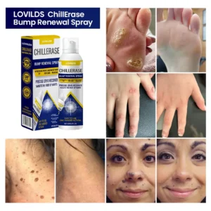 LOVILDS™ ChillErase Bump Renewal Spray