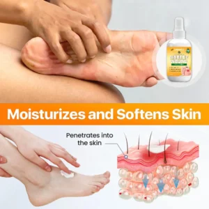 UNPREE™ Bee Venom Diabetic Wound Kolirin Spray