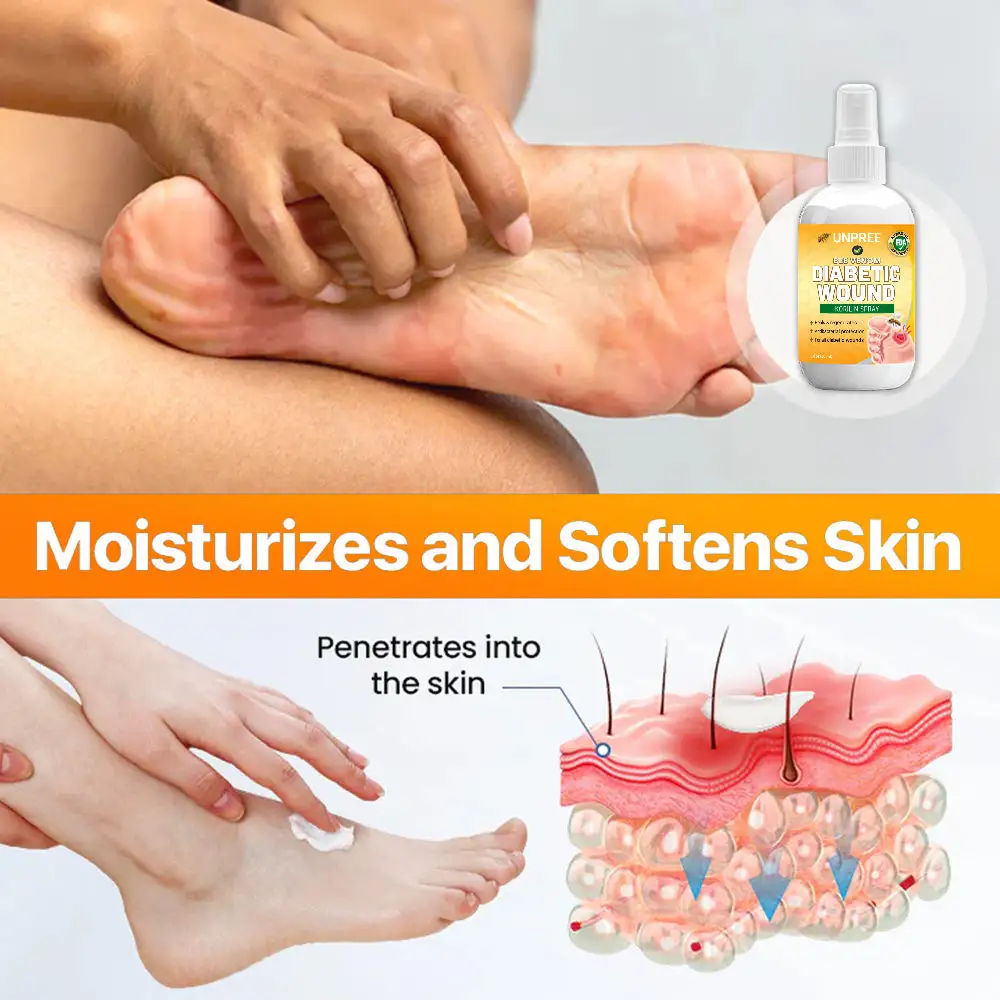 UNPREE™ Bee Venom Diabetic Wound Kolirin Spray