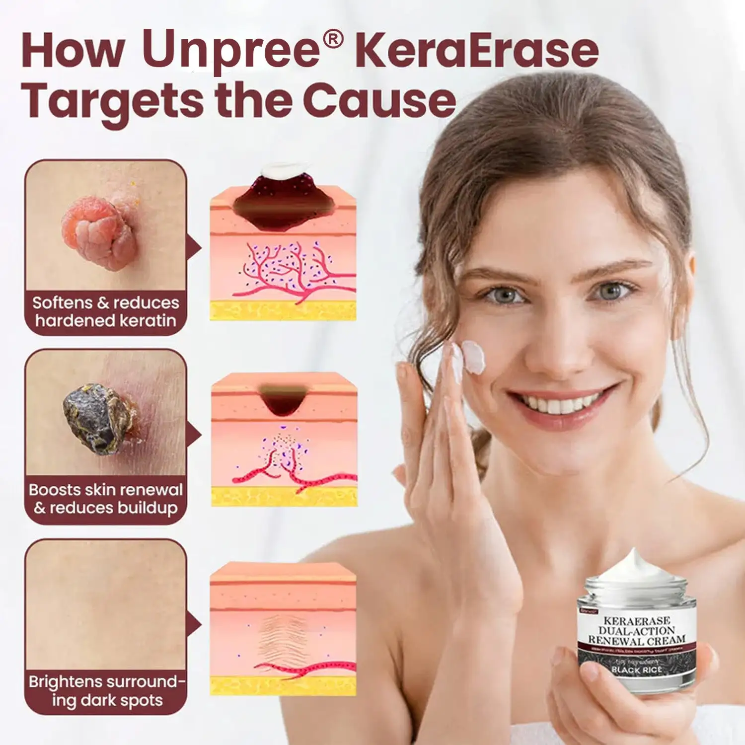 Unpree® KeraErase Dual-Action Renewal Cream