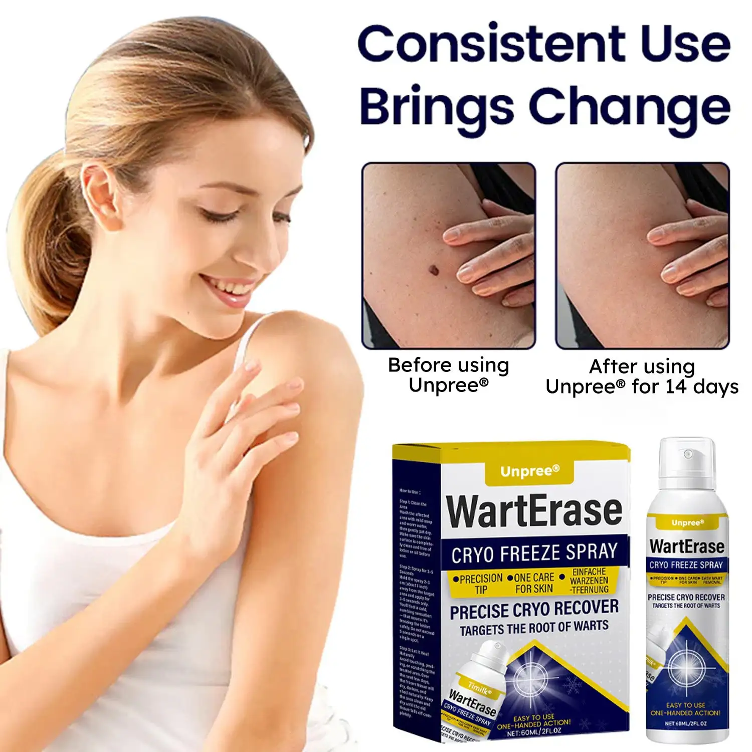 Unpree® WartErase Cryo Freeze Spray