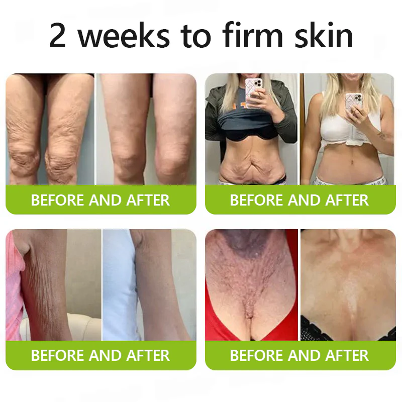 Lunaraé™ Botox & Retinol Shot