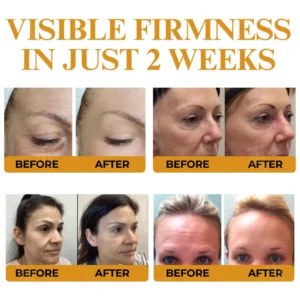 AEXZR® Letybo Bee Venom Wrinkle Removal Cream