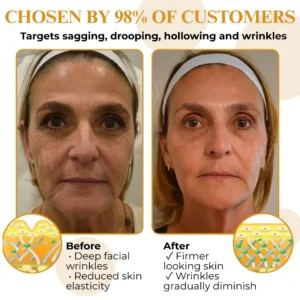 AEXZR® Letybo Bee Venom Wrinkle Removal Cream