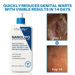 NanoLipo HPV Genital Warts Eraser Cream