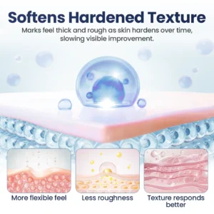 Nexisify® DERMALUX Texture Repair Gel