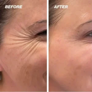 Hidone™ The Vita A Retinal Shot Tightening Booster