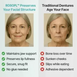 ROSOPL™ Custom-Fit Functional Dentures