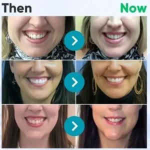 Hidone® VioCore Bee Venom Dental Treatment Toothpaste