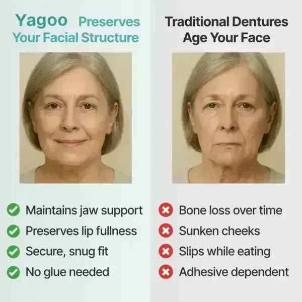 Yagoo™ Medical Full Denture with Strong Suction